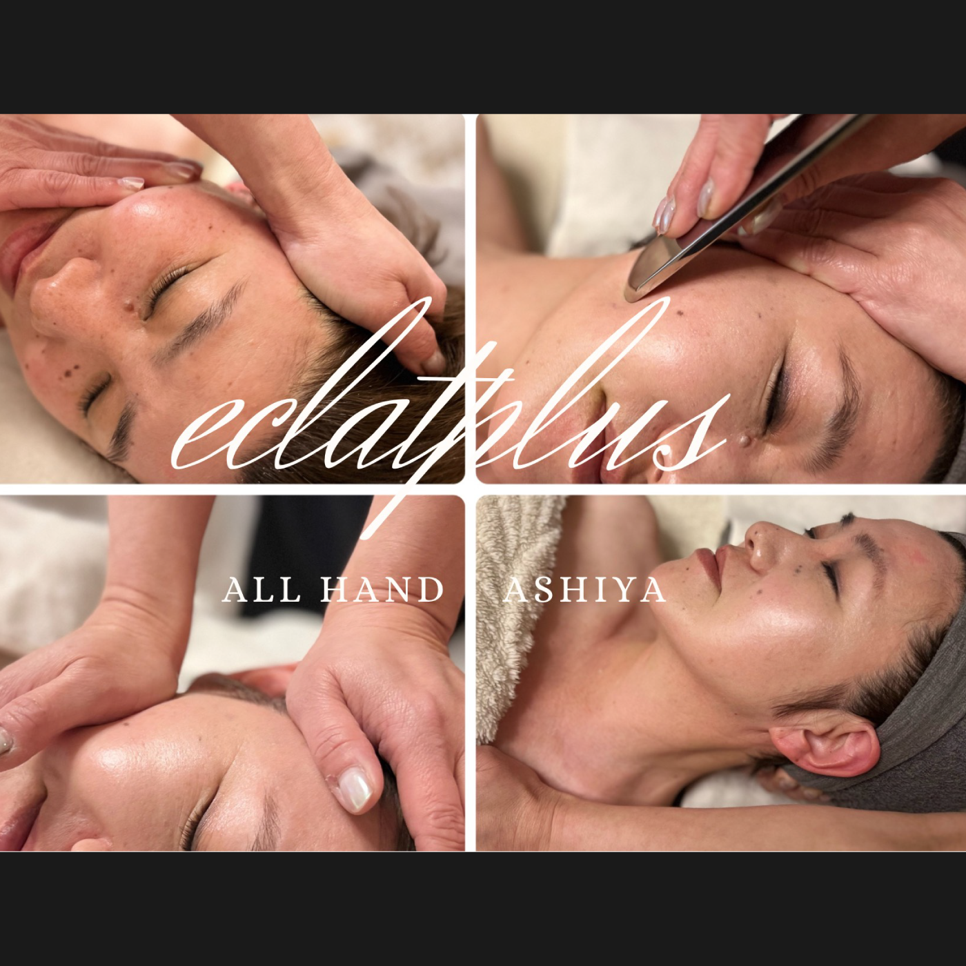 オールハンド小顔矯正のビフォアー・アフター事例5