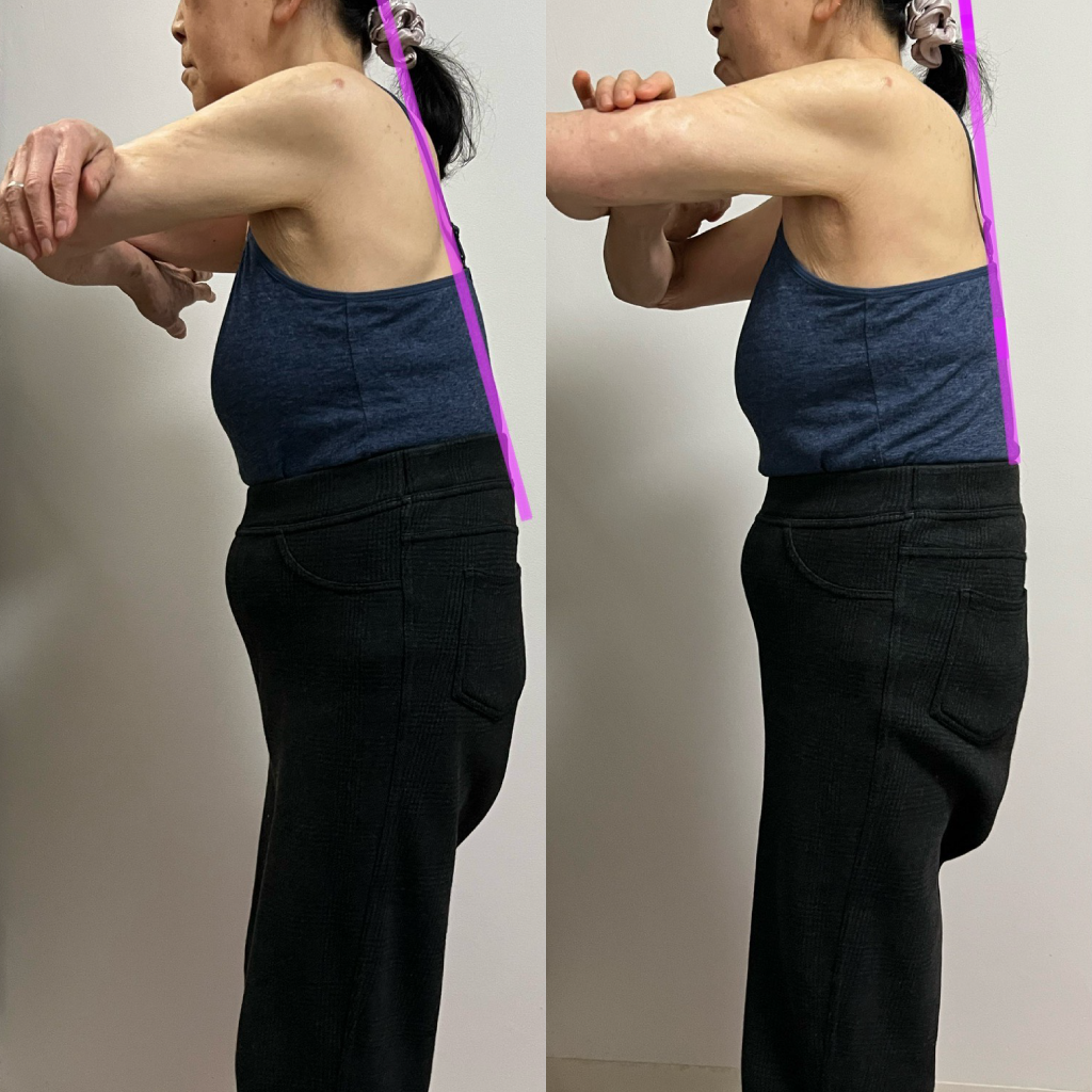 痩身エステ・カイロプラクティックの施術写真