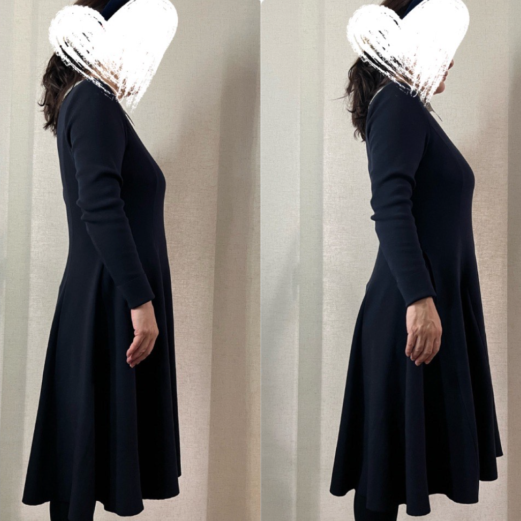 痩身エステの施術写真